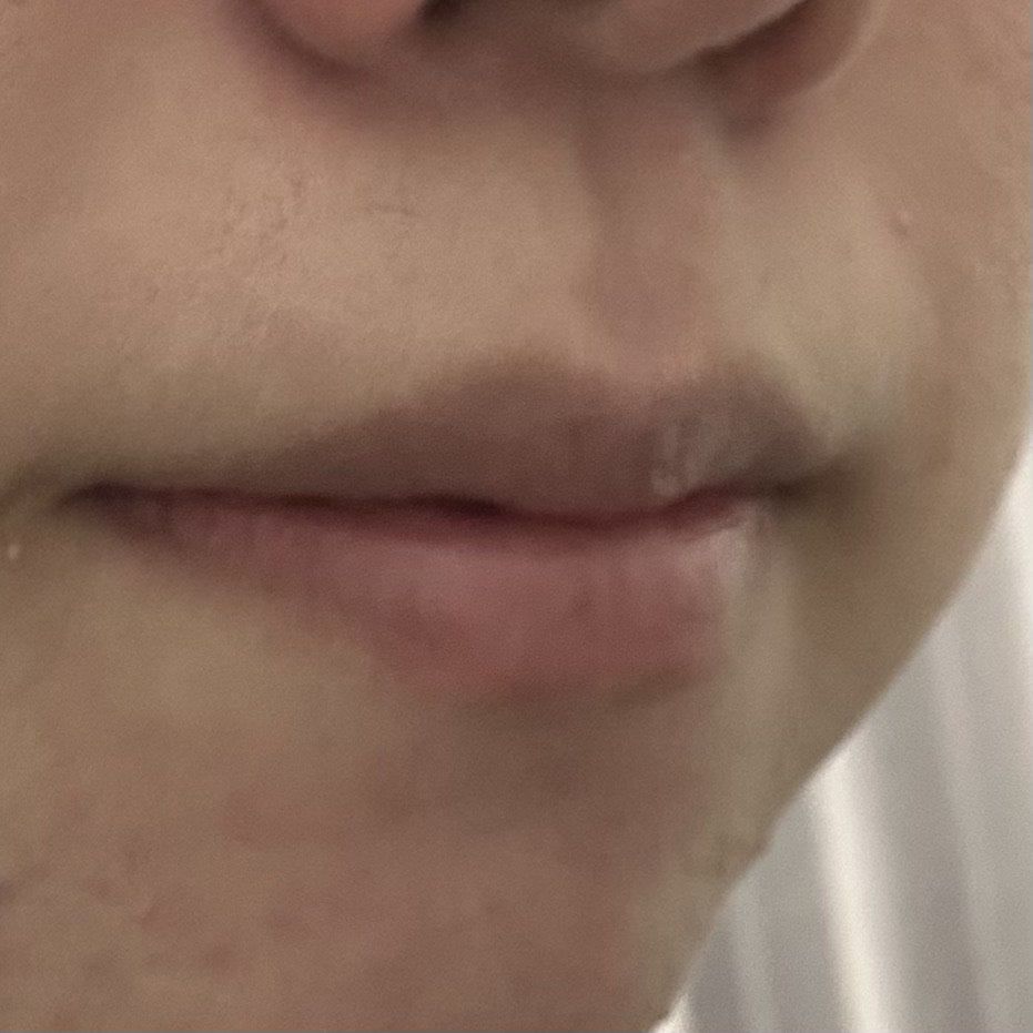 メンソレータム リップフォンデュ/メンソレータム/リッププランパーを使ったクチコミ（2枚目）