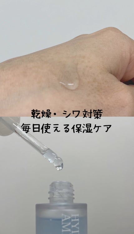 ãã€ãã©Aã¢ã³ãã«/Dr.lonnie/çŸå®¹æ¶²ã䜿ã£ãã¯ãã³ãïŒ2æç®ïŒ