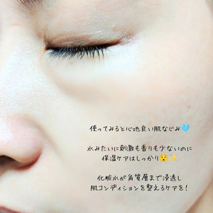 タカミスキンピール/タカミ/ブースター・導入液を使ったクチコミ(6枚目)