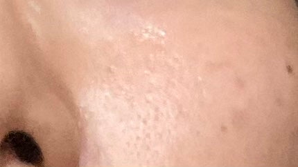 AN on LIPS 「顔洗いすぎで化粧水とかピリピリ染みてきた💦TISSのうたい文句..」(6枚目)