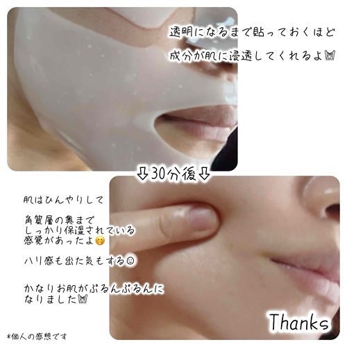ゆみこ先生🦷 on LIPS 「#prドクター設計のゲルマスクがデビュー💓@dr.ninete..」(3枚目)