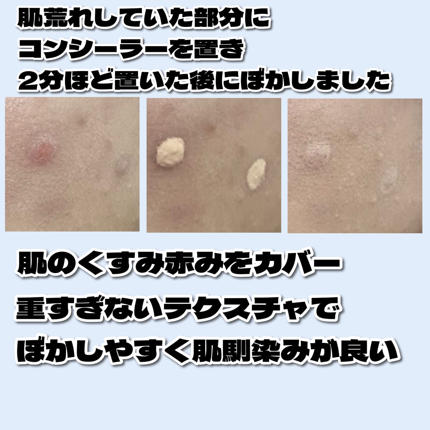 ロングラスティングチップコンシーラー/LUNA/リキッドコンシーラーを使ったクチコミ(3枚目)