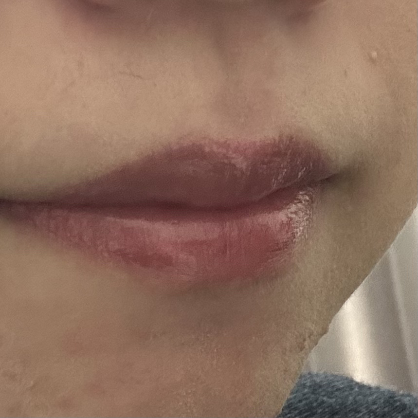 メンソレータム リップフォンデュ/メンソレータム/リッププランパーを使ったクチコミ（1枚目）