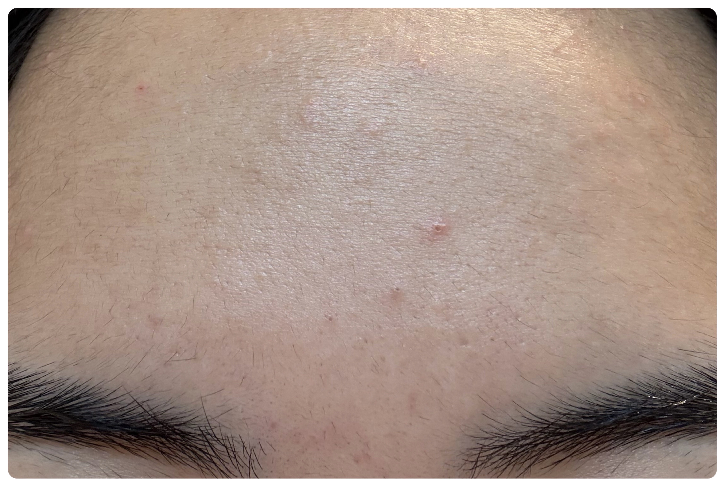 AGE-R ブースタープロ/MEDICUBE/美顔器・マッサージを使ったクチコミ（3枚目）