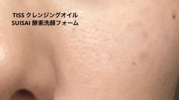 AN on LIPS 「顔洗いすぎで化粧水とかピリピリ染みてきた💦TISSのうたい文句..」(3枚目)