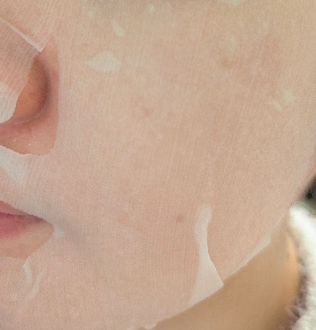 ごめんね素肌 キニナルマスク/クリアターン/シートマスク・パックを使ったクチコミ(6枚目)