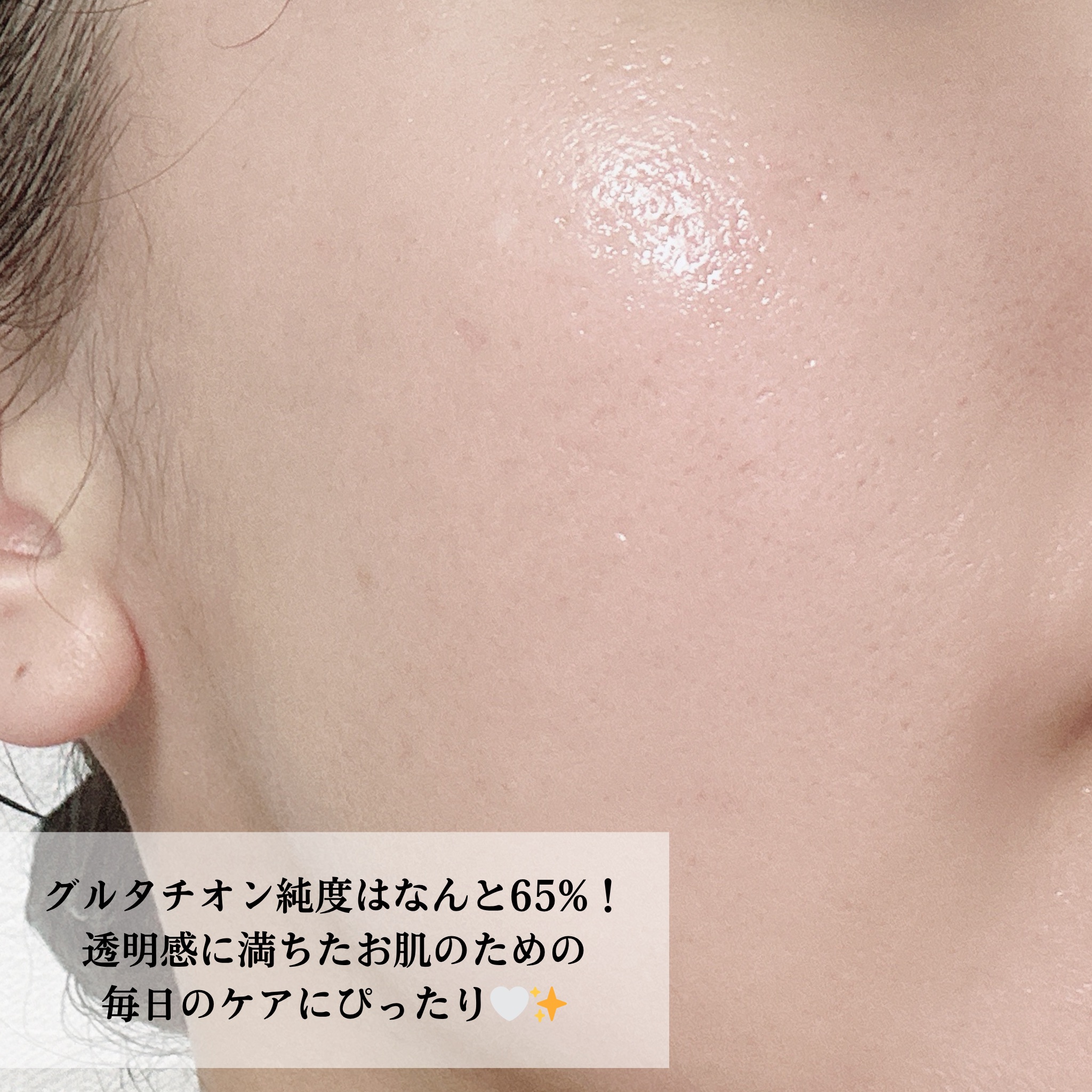 ヨエスターGLTダイレクトウルトラX/ESTHER FORMULA/美容サプリメントを使ったクチコミ（3枚目）