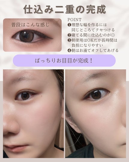 アイリーヌ/ミリオナ化粧品/美容液を使ったクチコミ(3枚目)