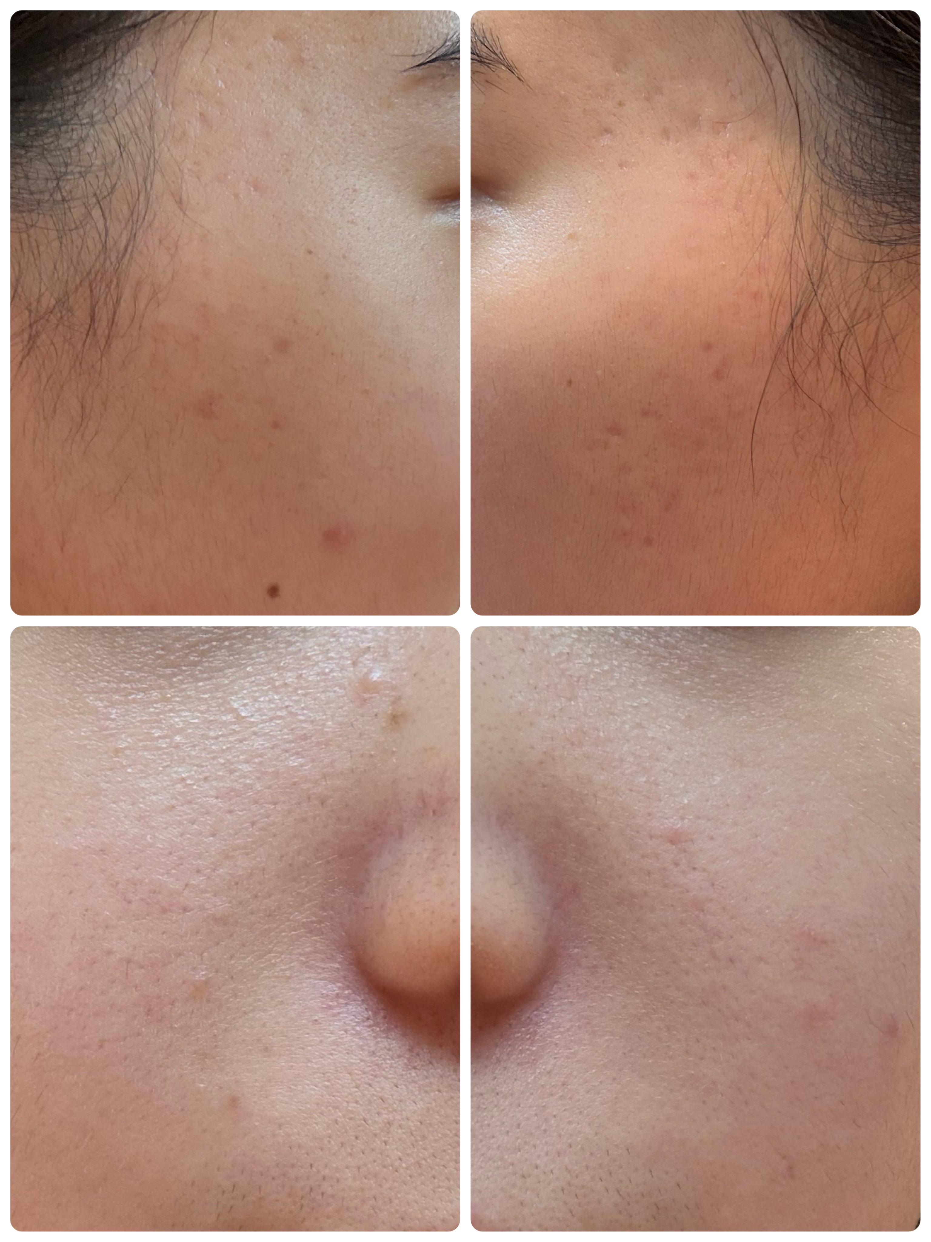 AGE-R ブースタープロ/MEDICUBE/美顔器・マッサージを使ったクチコミ（2枚目）