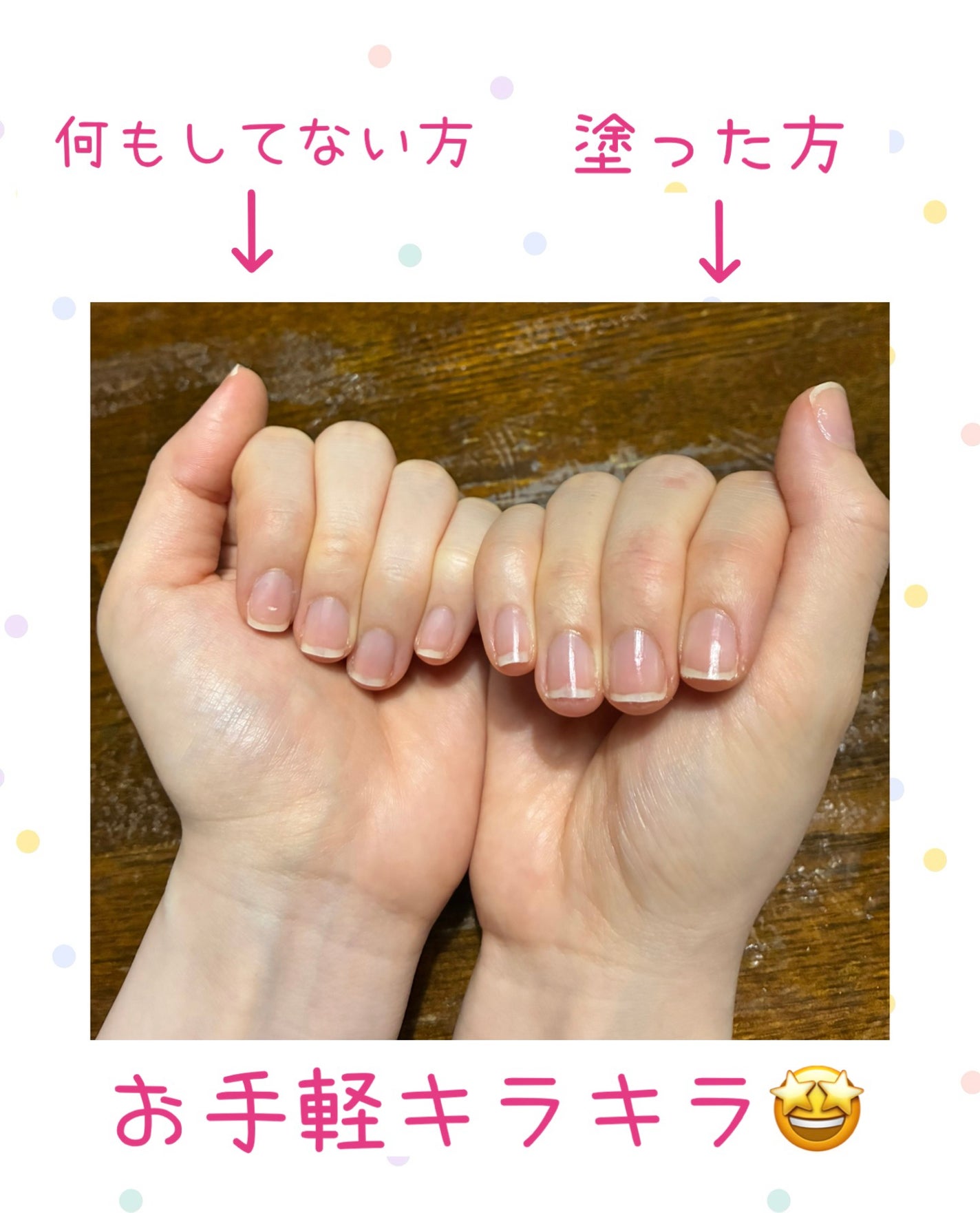 エテュセ クイックケアコート/ettusais/ネイルオイル・トリートメントを使ったクチコミ(2枚目)