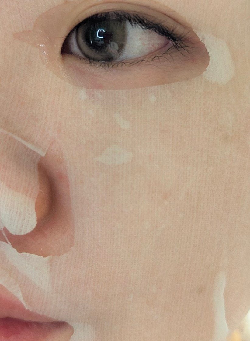 ごめんね素肌 キニナルマスク/クリアターン/シートマスク・パックを使ったクチコミ(5枚目)