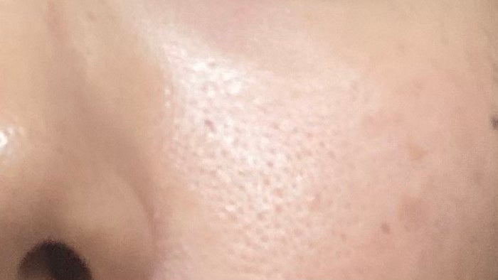 AN on LIPS 「顔洗いすぎで化粧水とかピリピリ染みてきた💦TISSのうたい文句..」(2枚目)