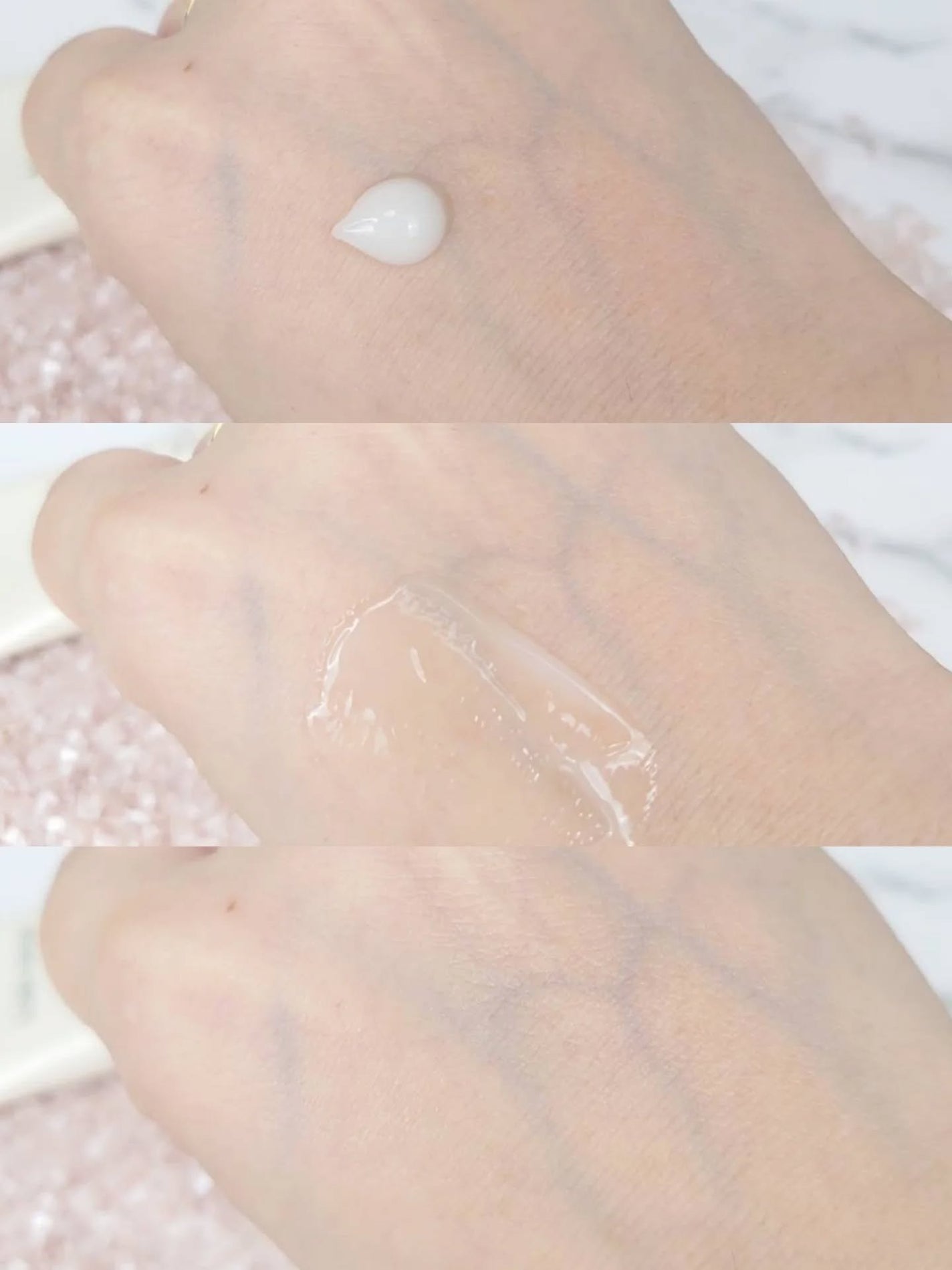 EIOM アクネクスクリーム/EIOM/フェイスクリームを使ったクチコミ(3枚目)