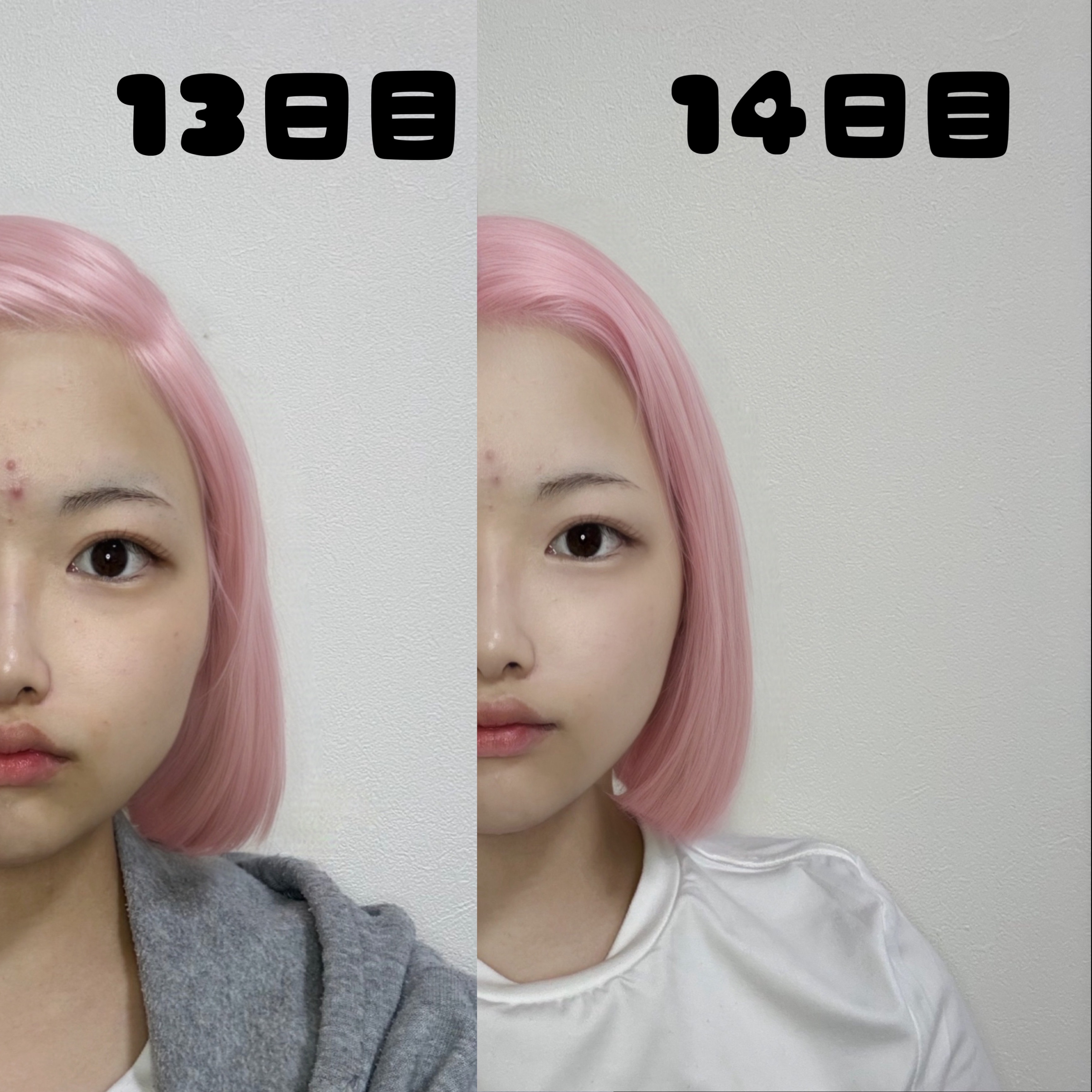 薬用しみ対策 美白乳液【医薬部外品】/メラノCC/乳液を使ったクチコミ（2枚目）