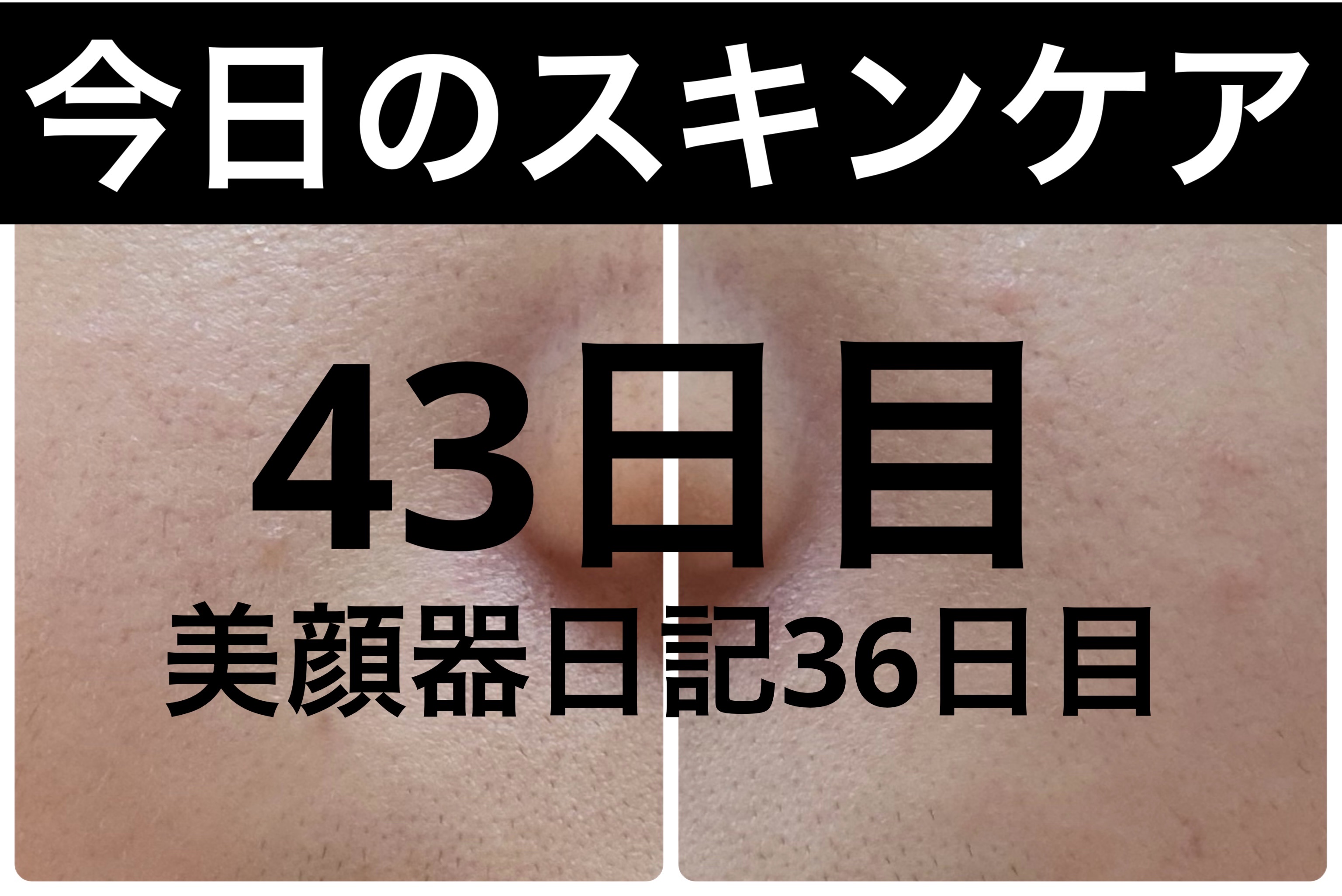 AGE-R ブースタープロ/MEDICUBE/美顔器・マッサージを使ったクチコミ（1枚目）