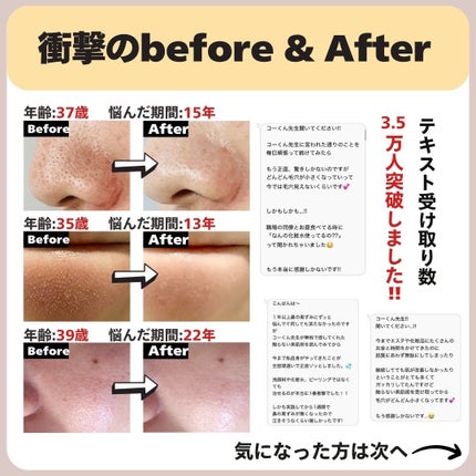 あなたの肌に合ったスキンケア💐コーくん先生 on LIPS 「【知らないとマジ損】角栓はこれで一撃です🤫..あなたのニキビ・..」(7枚目)