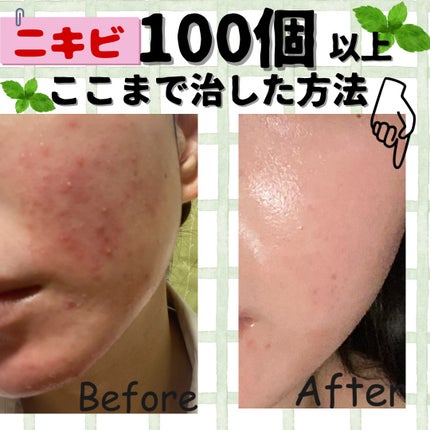 シークレットビューティーパウダー/キャンメイク/プレストパウダーを使ったクチコミ(1枚目)