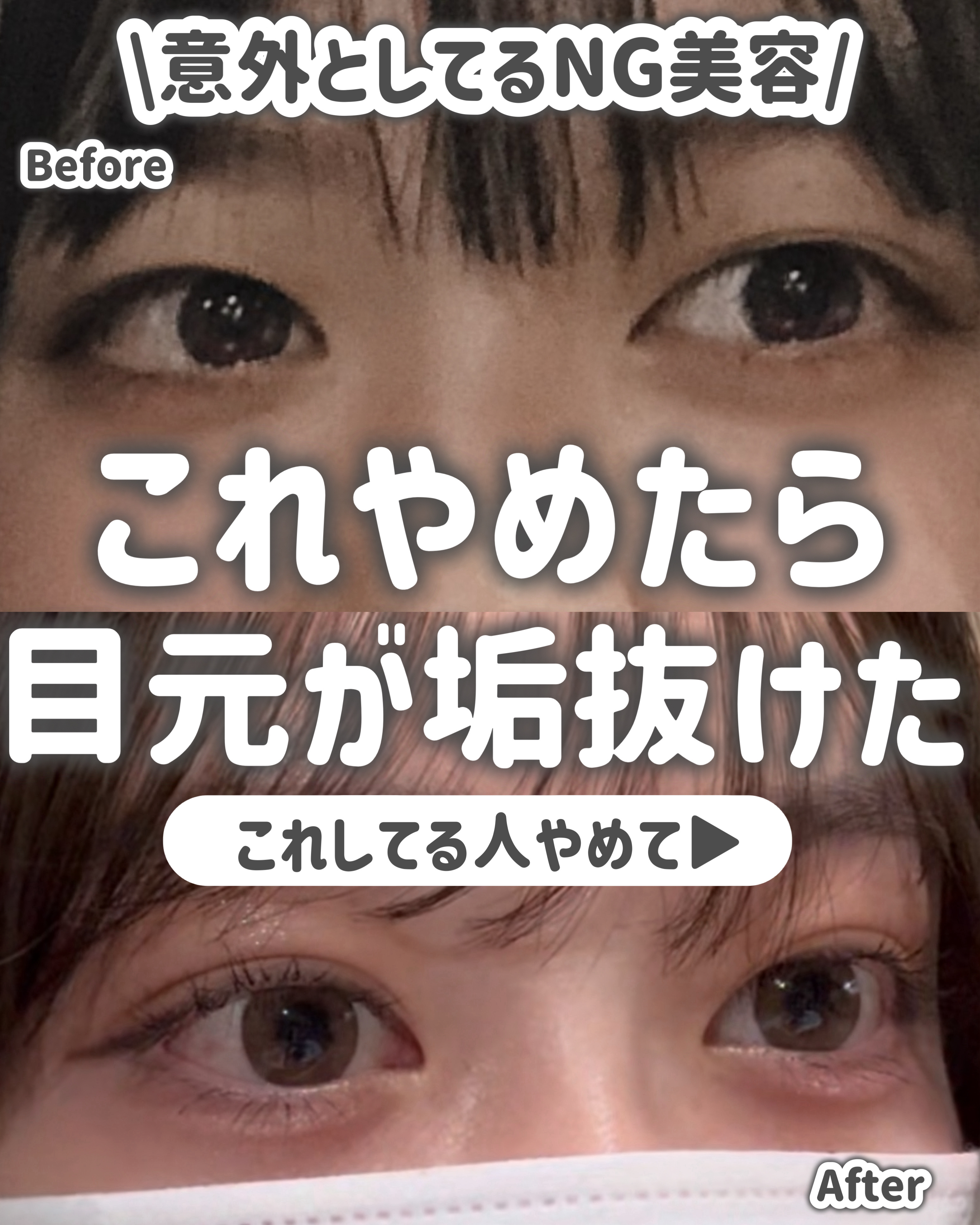 ナチュラルアイロールオンN/カントリー&ストリーム/アイケア・アイクリームを使ったクチコミ（1枚目）