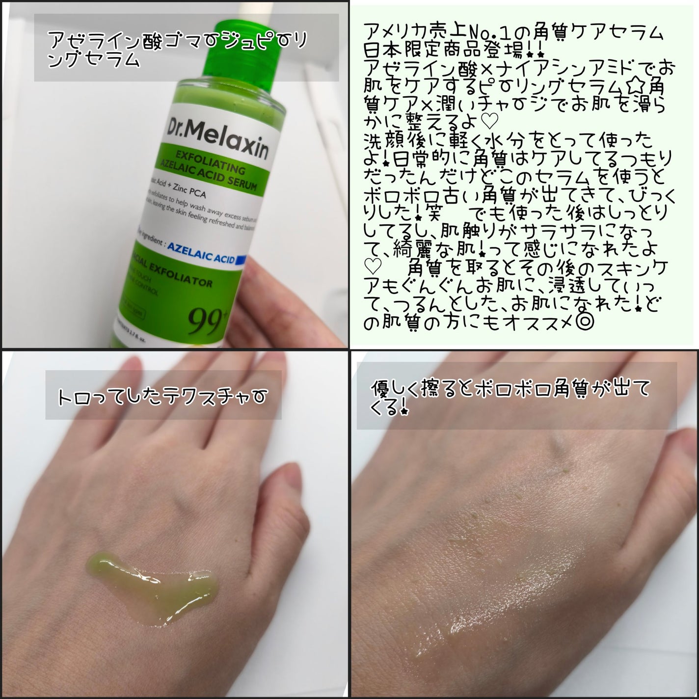 アゼライン酸ゴマージュピーリングセラム/Dr.Melaxin/美容液を使ったクチコミ(3枚目)