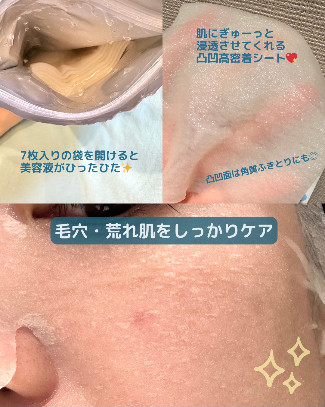 クリアターン　アゼライン酸BOMBマスク/クリアターン/シートマスク・パックを使ったクチコミ（3枚目）