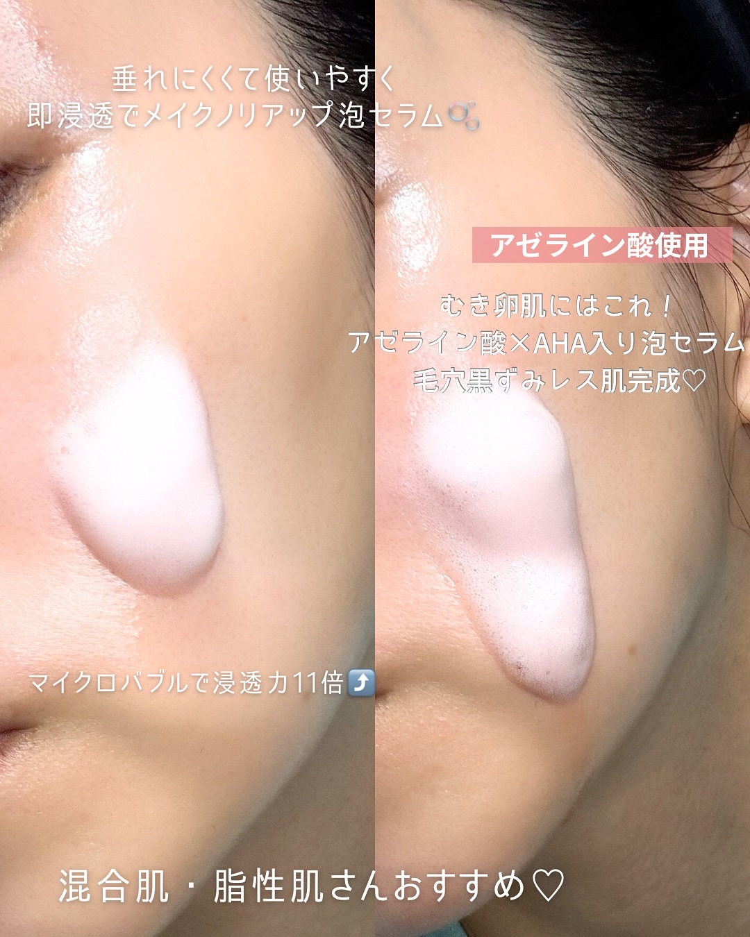 レチノール コラーゲン ピンクマイクロバブルセラム/VT/美容液を使ったクチコミ（2枚目）