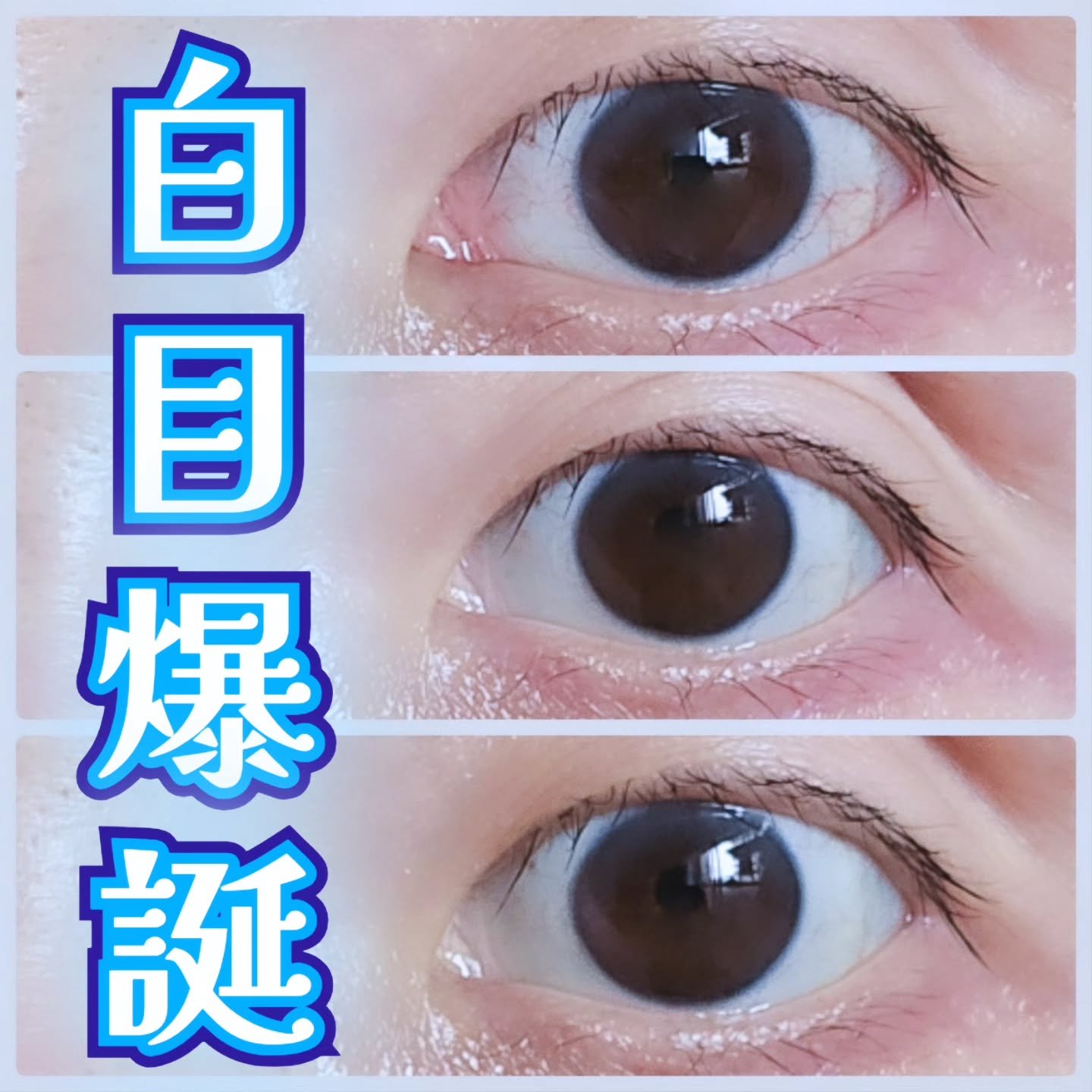 マイティアルミファイ（医薬品）/第一三共ヘルスケア/その他を使ったクチコミ（1枚目）