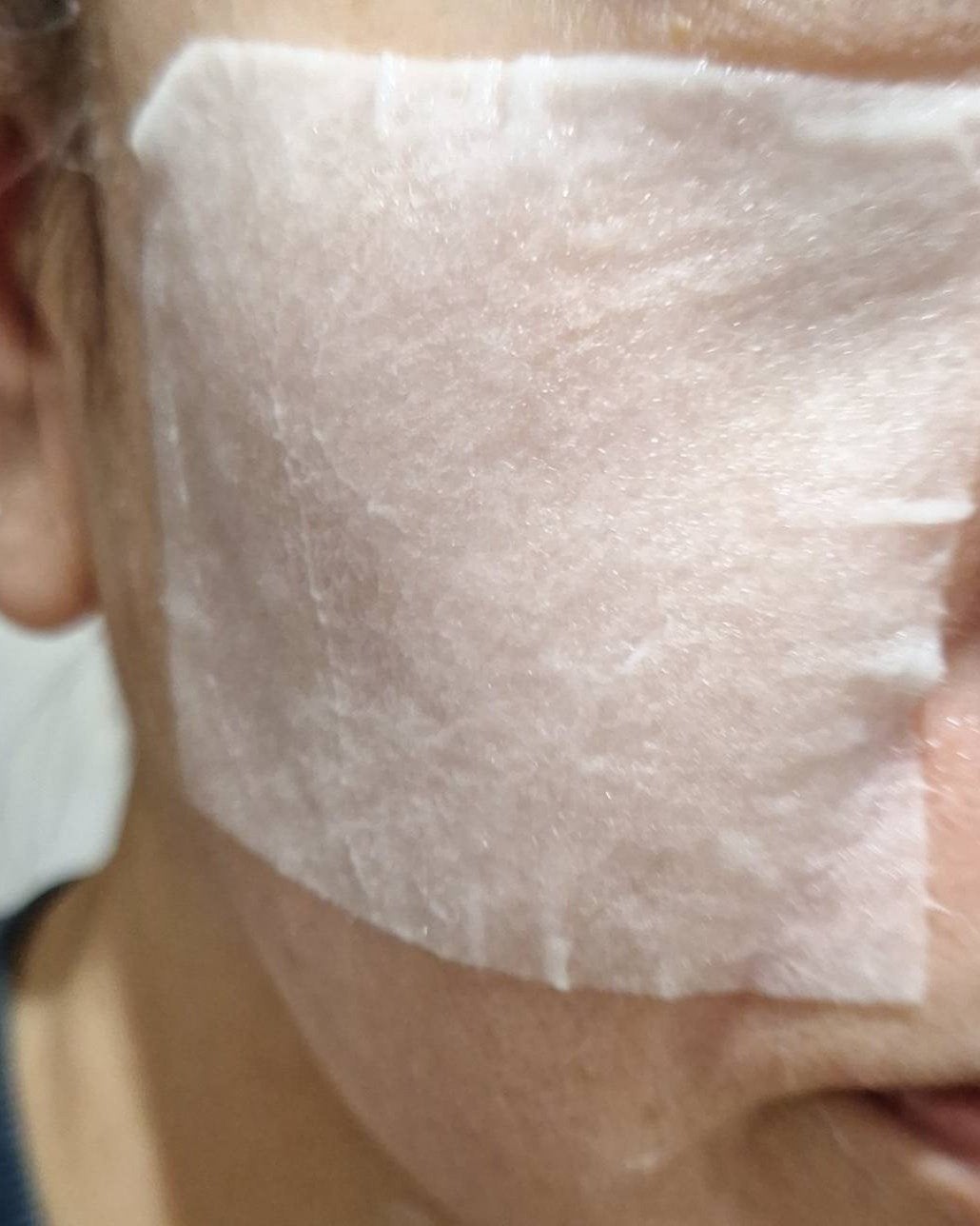 にゃつぼ on LIPS 「これ、使ってみました!リズムピコレーザーニードルスポットパック..」(3枚目)