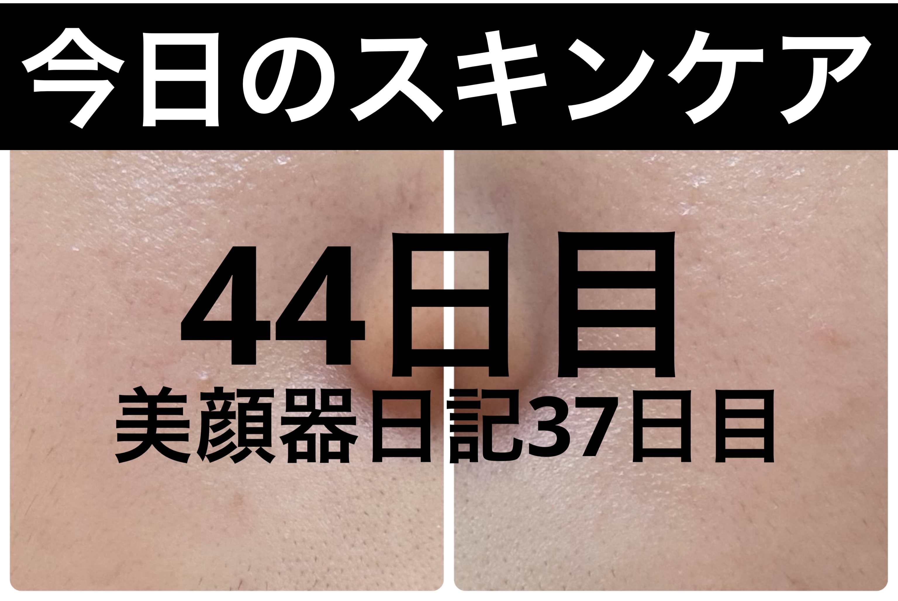 薬用雪肌精 ブライトニング クレンジング オイル[医薬部外品]/雪肌精/オイルクレンジングを使ったクチコミ（1枚目）