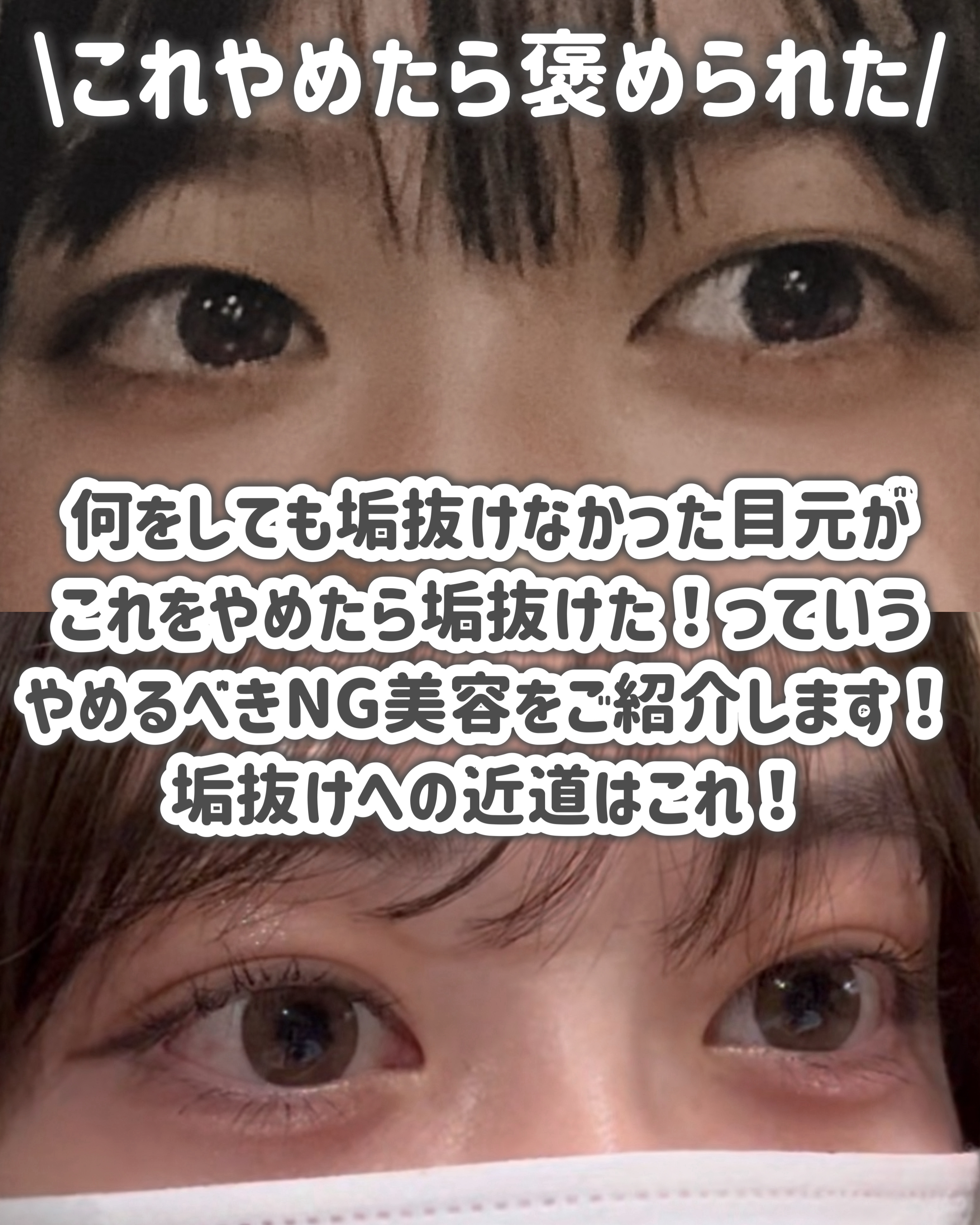 ナチュラルアイロールオンN/カントリー&ストリーム/アイケア・アイクリームを使ったクチコミ（2枚目）