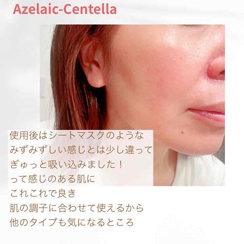 HydroB5 スキンマグネットマスク/Dr.nineteen/シートマスク・パックを使ったクチコミ（3枚目）