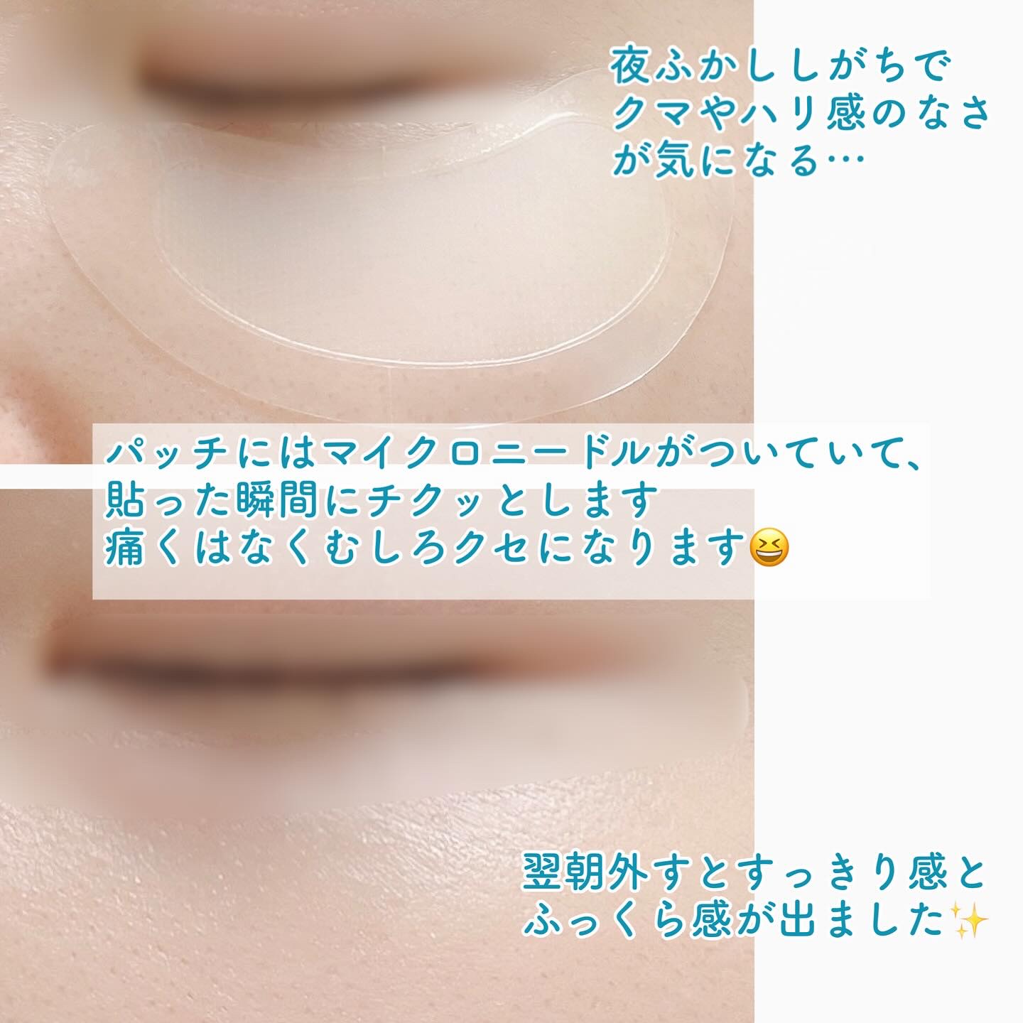 アイバックリフト1100シャットリードルパッチ/CHARDE/シートマスク・パックを使ったクチコミ（3枚目）