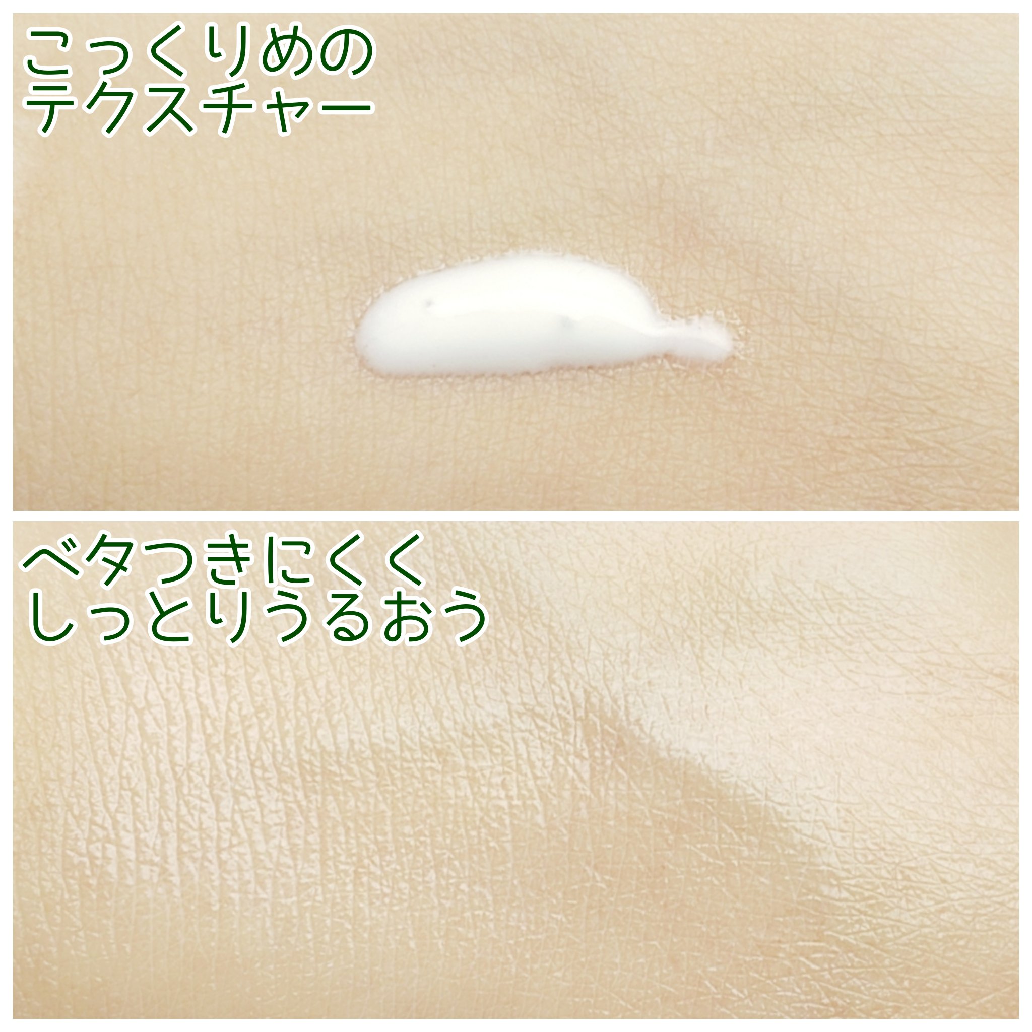 PDRN+リードルS 100/VT/美容液を使ったクチコミ（3枚目）