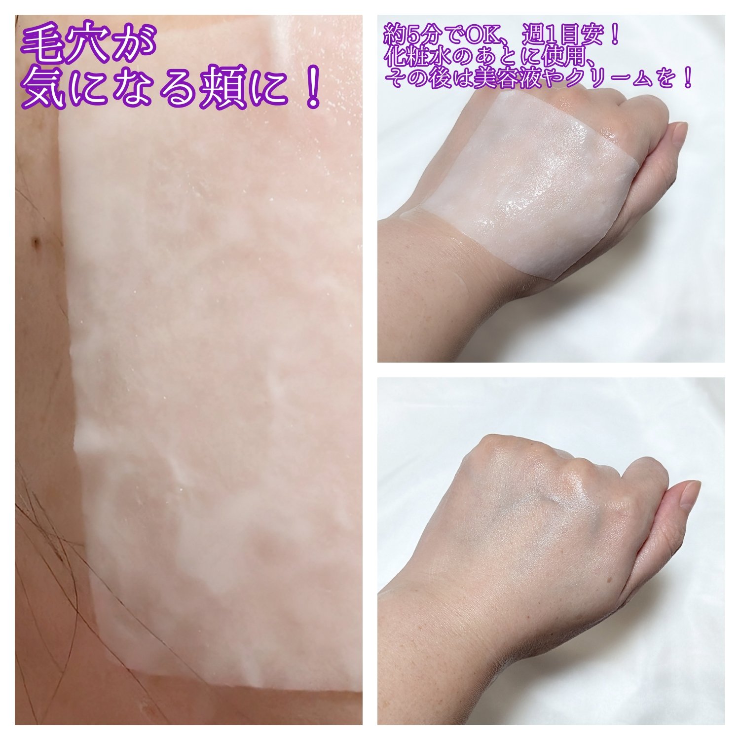 リズム ピコレーザー ニードルスポットパック/RISM/シートマスク・パックを使ったクチコミ（3枚目）