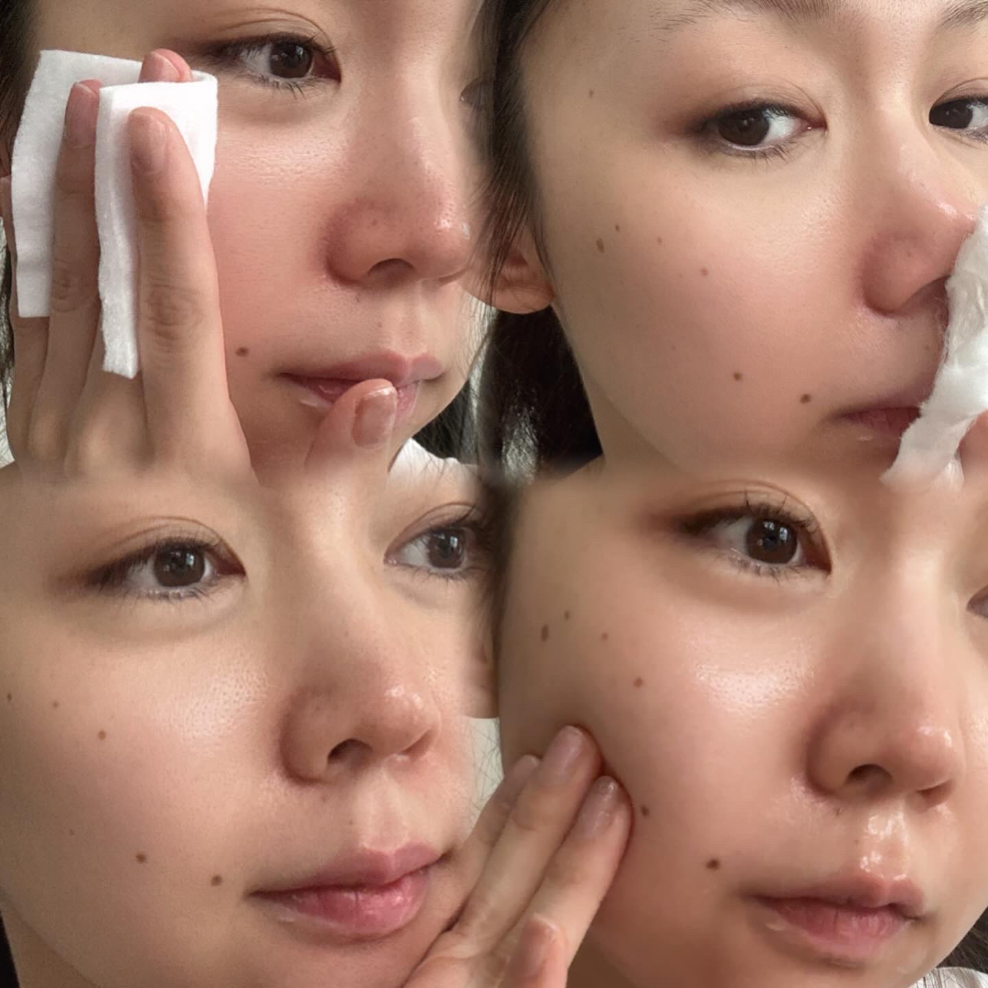 オードムーゲVC 薬用ふきとり化粧水/オードムーゲ/拭き取り化粧水を使ったクチコミ（3枚目）