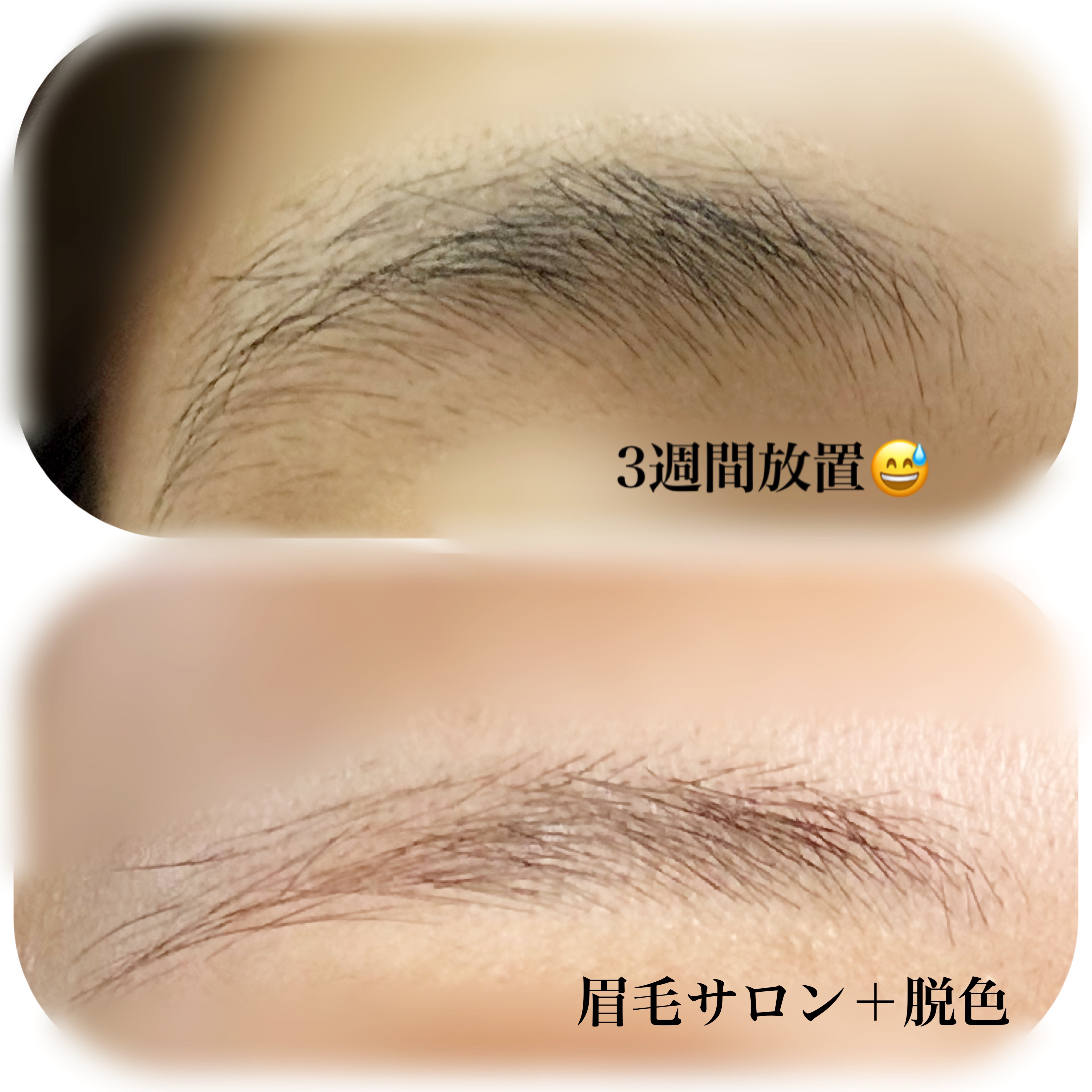 脱色クリーム 敏感肌用 55g＋55g/エピラット/ムダ毛ケアを使ったクチコミ（2枚目）