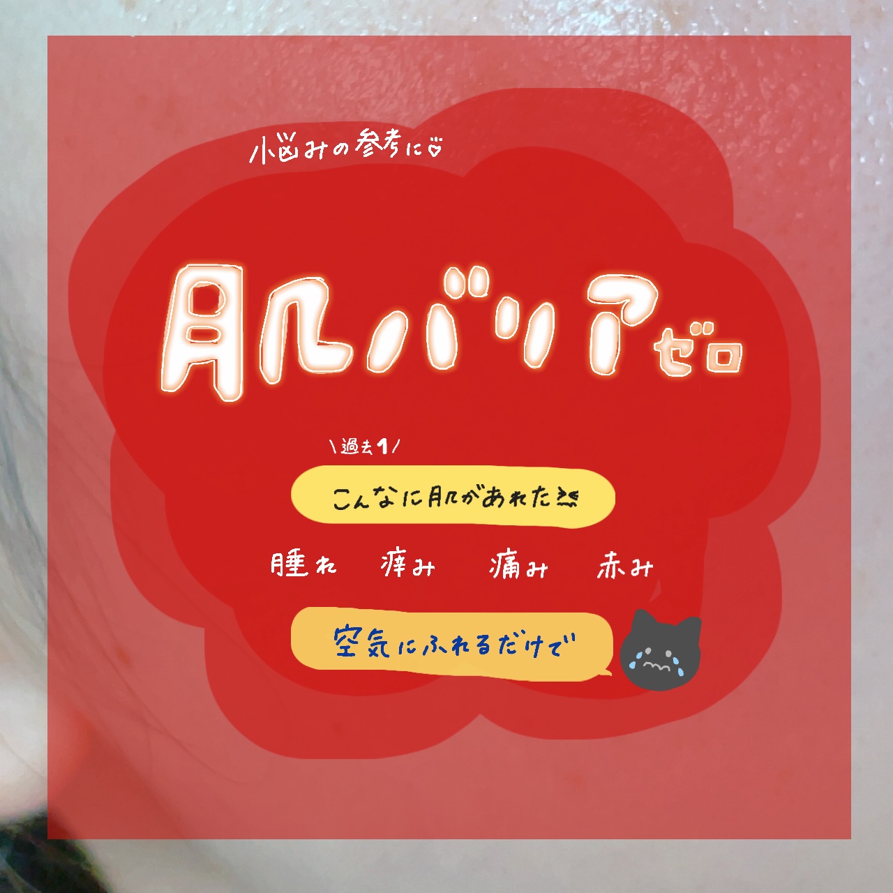 ピュアベール(医薬品)/プロペト/その他を使ったクチコミ（1枚目）