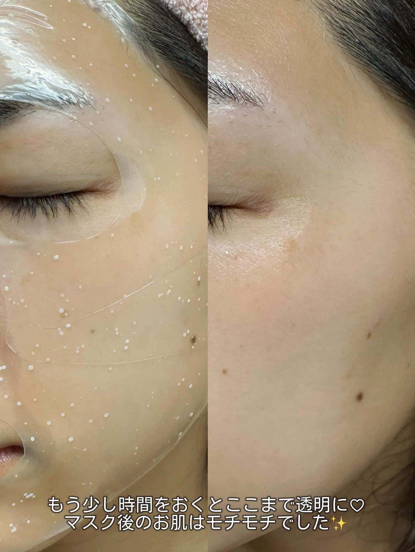 HydroB5 スキンマグネットマスク/Dr.nineteen/シートマスク・パックを使ったクチコミ(5枚目)