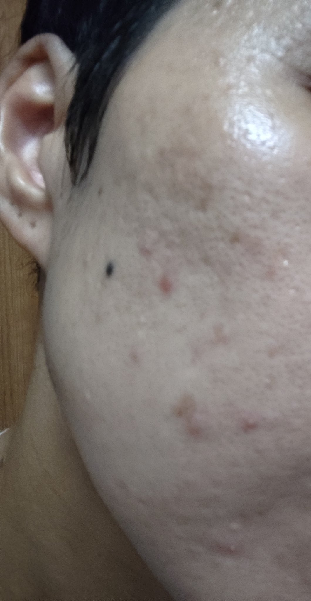 ネオ小町錠(医薬品)/摩耶堂製薬/その他を使ったクチコミ(5枚目)