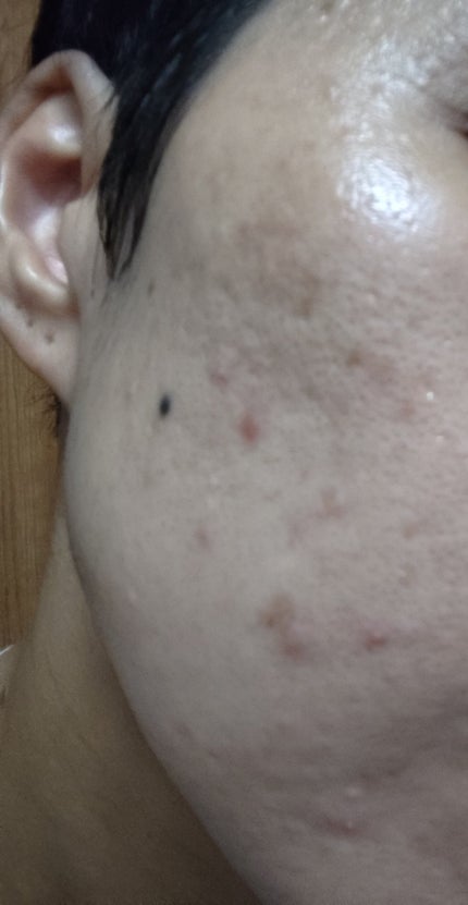 ネオ小町錠(医薬品)/摩耶堂製薬/その他を使ったクチコミ(5枚目)