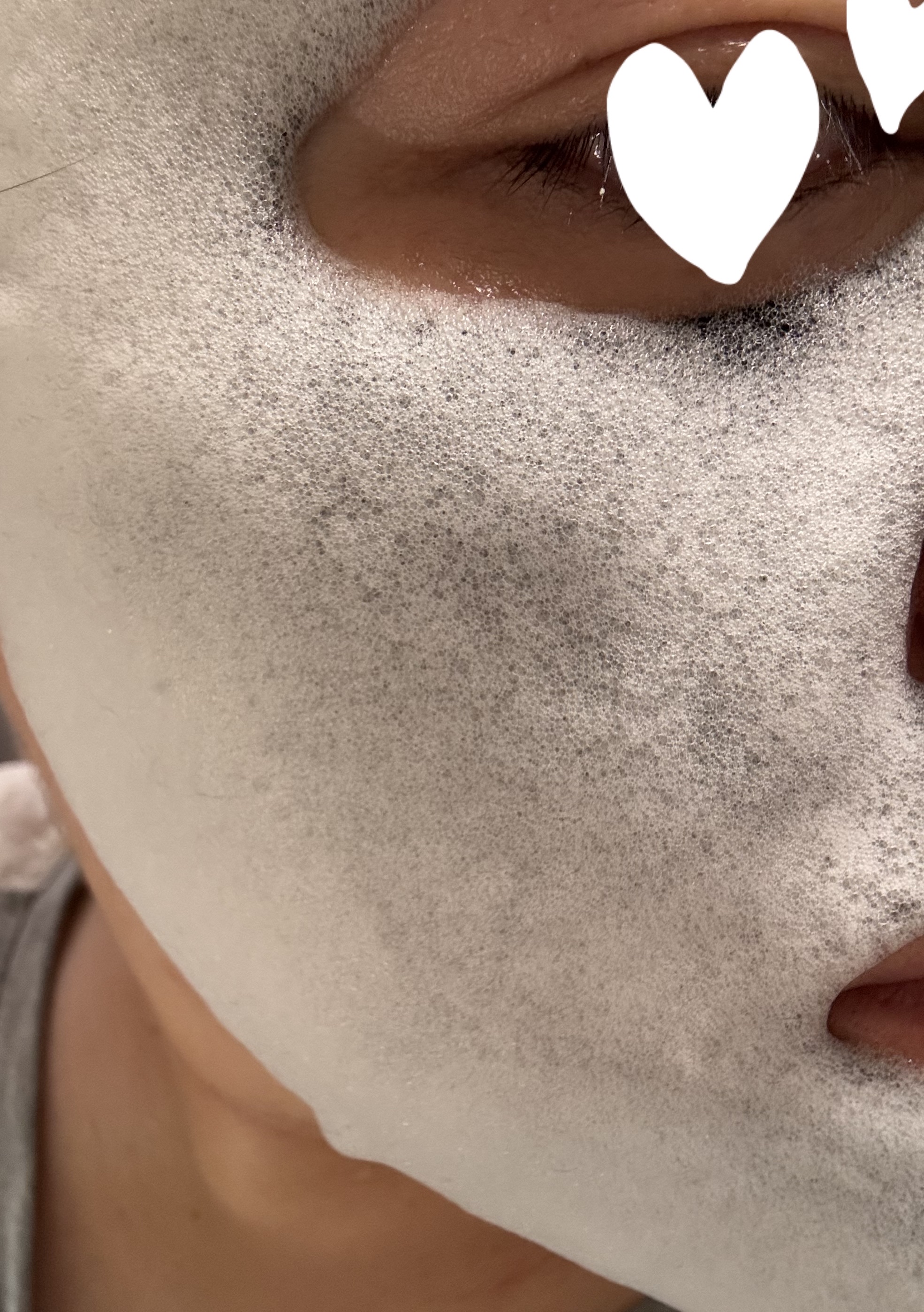 バブルトックトック マスク/DAISO/シートマスク・パックを使ったクチコミ（3枚目）