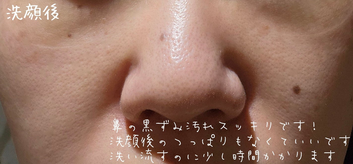 ダヴ 吸着毛穴ケア 洗顔ジェル/ダヴ/その他洗顔料を使ったクチコミ(4枚目)