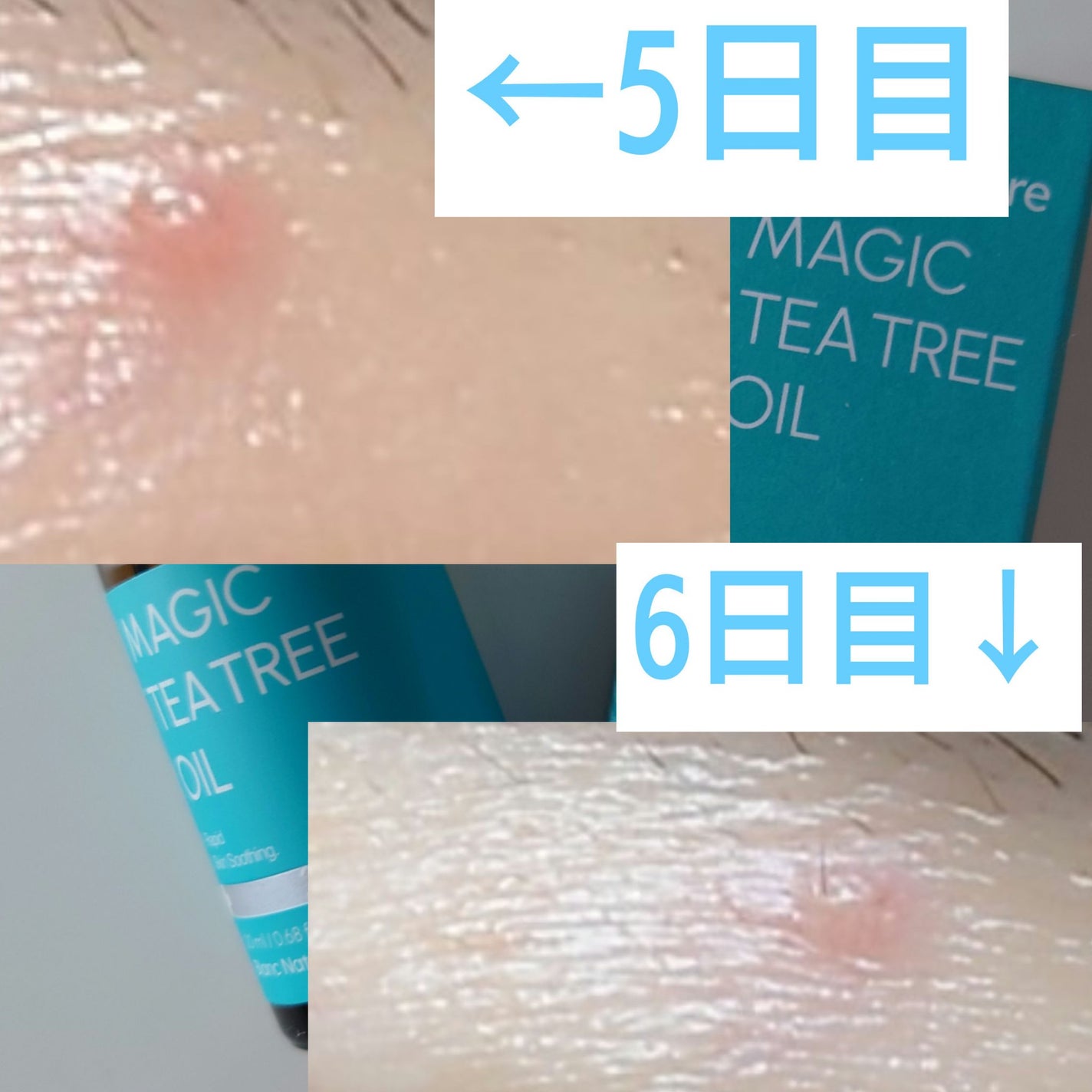 マジックティーツリーオイル/ブラン/フェイスオイルを使ったクチコミ(4枚目)