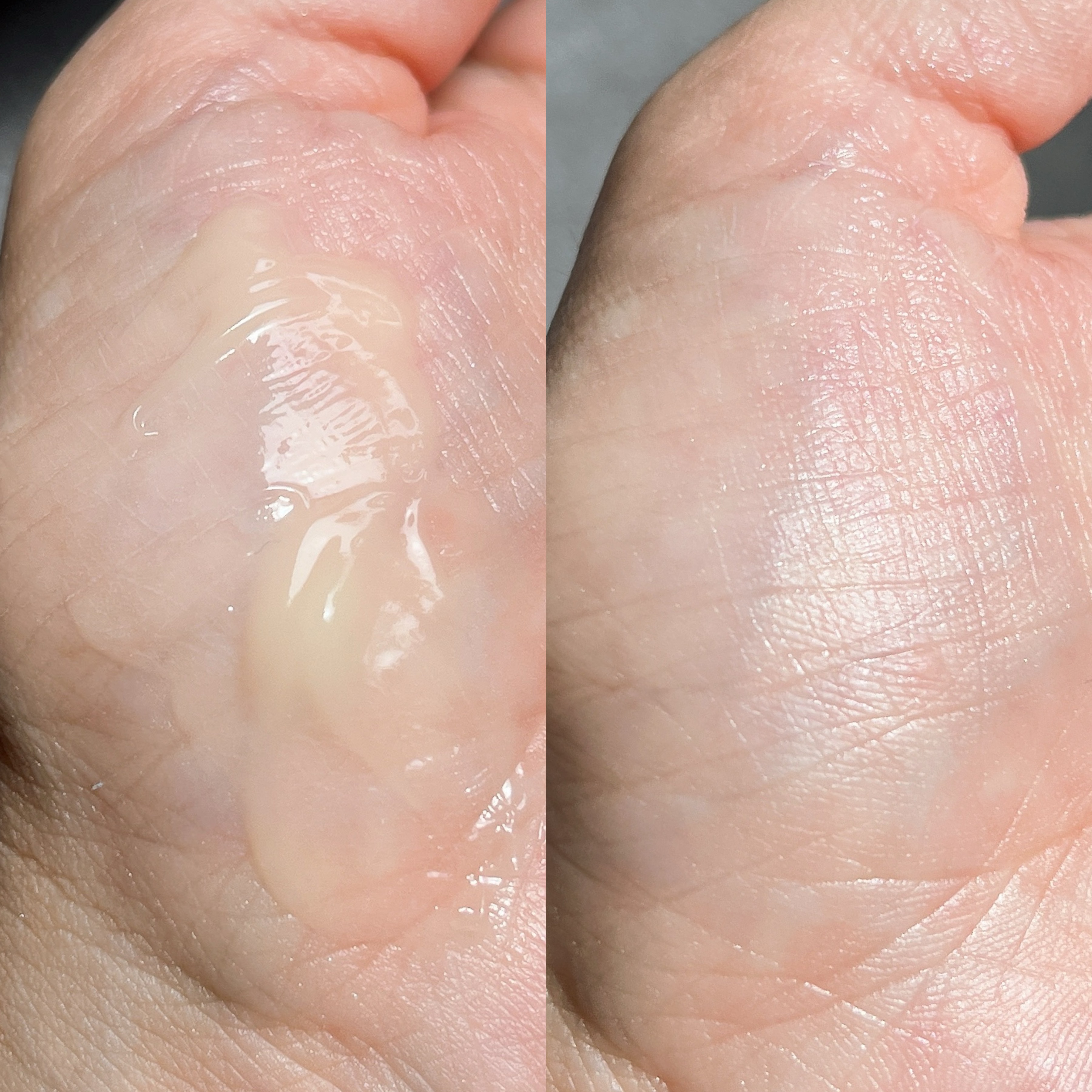 薬用アクアコラーゲンゲル エンリッチリンクルリペア/ドクターシーラボⓇ/フェイスクリームを使ったクチコミ（3枚目）