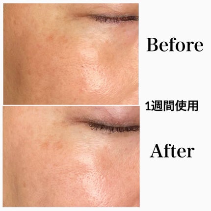 5番 白玉グルタチオン100×TXA10集中トーニング美容液/numbuzin/美容液を使ったクチコミ(3枚目)