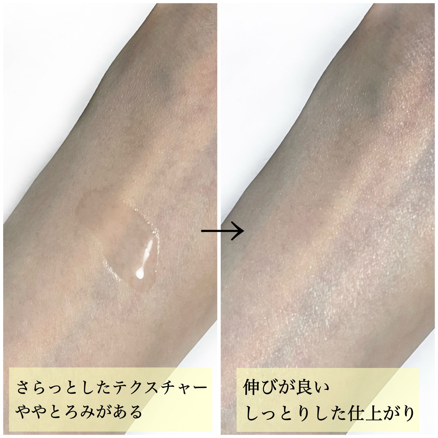 モイストケア ローション MB/d プログラム/化粧水を使ったクチコミ(4枚目)