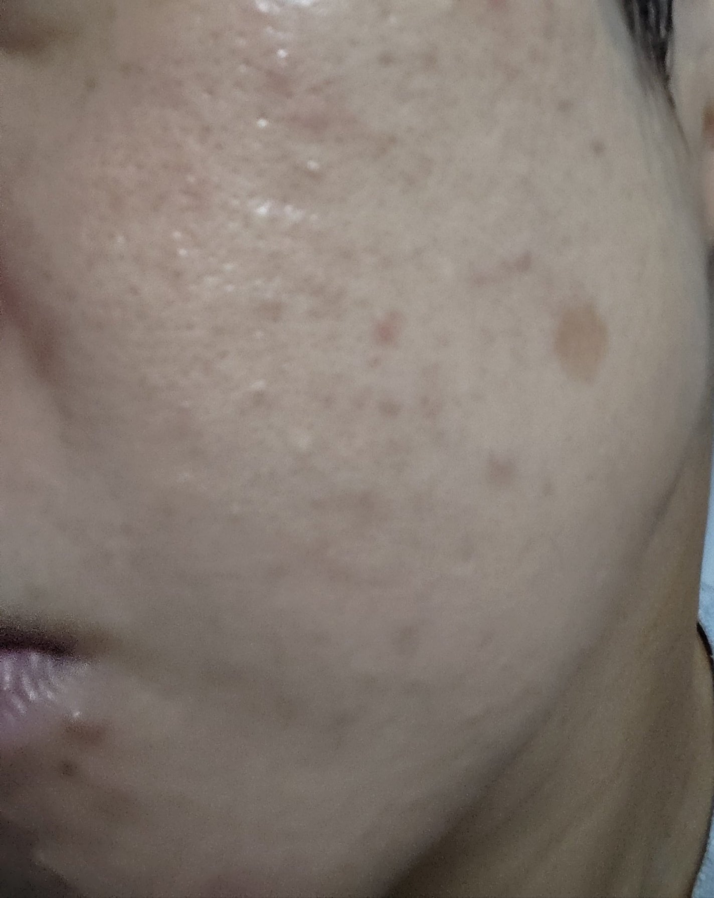 ネオ小町錠(医薬品)/摩耶堂製薬/その他を使ったクチコミ(6枚目)