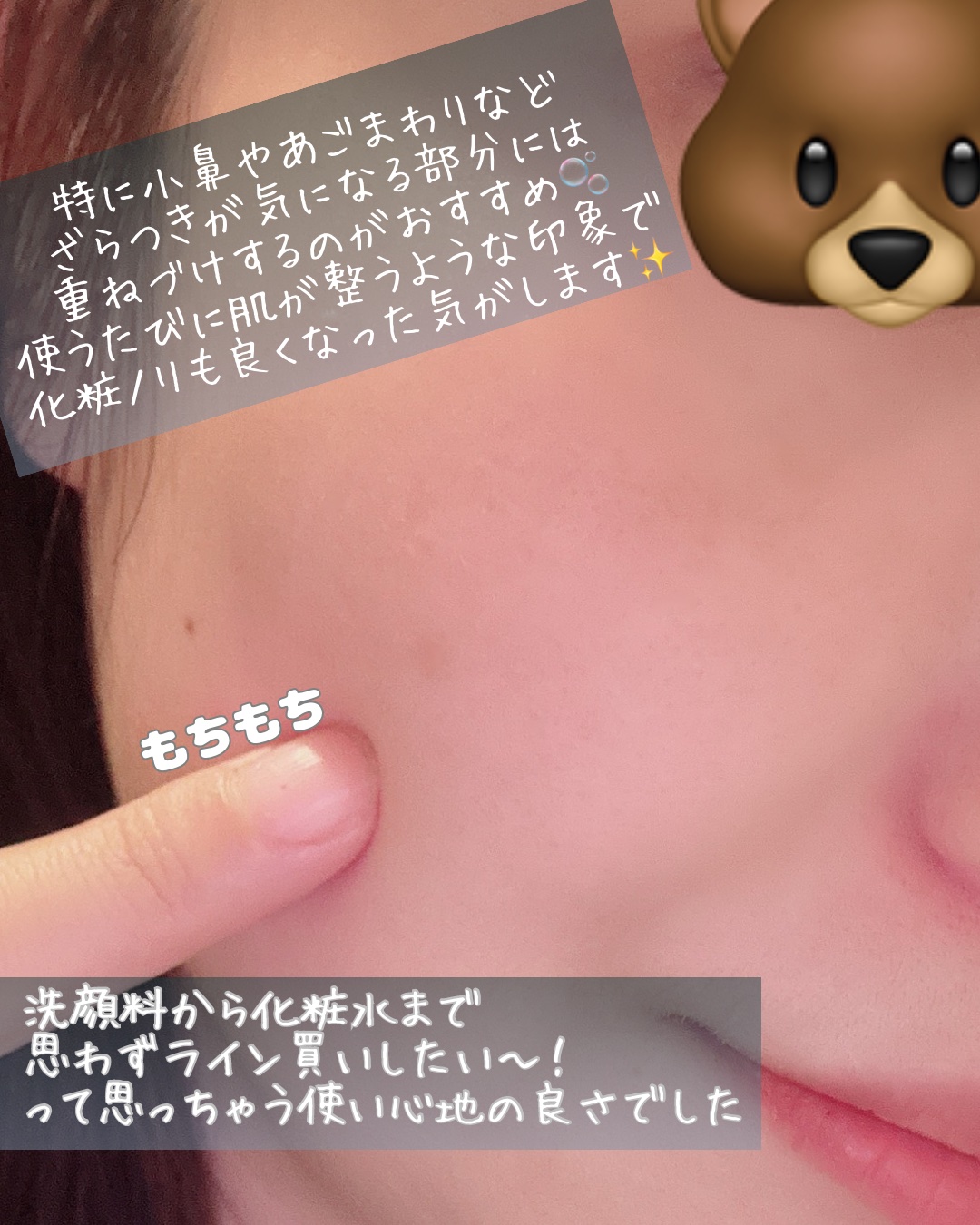 エファクラ ピールケア セラム/ラ ロッシュ ポゼ/美容液を使ったクチコミ（3枚目）