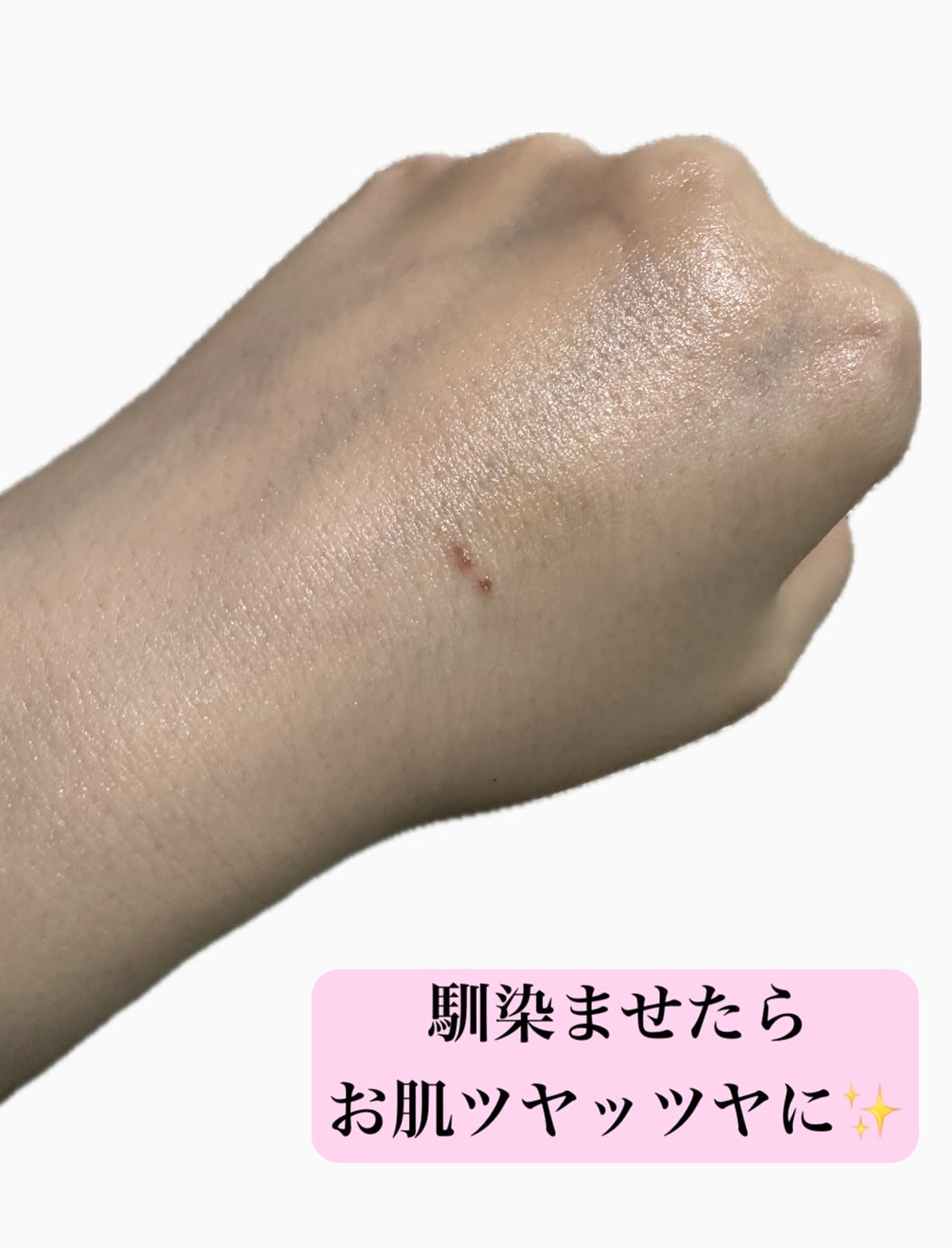 メラキャプチャーアンプルカプセルクリーム/センテリアン24/フェイスクリームを使ったクチコミ(3枚目)