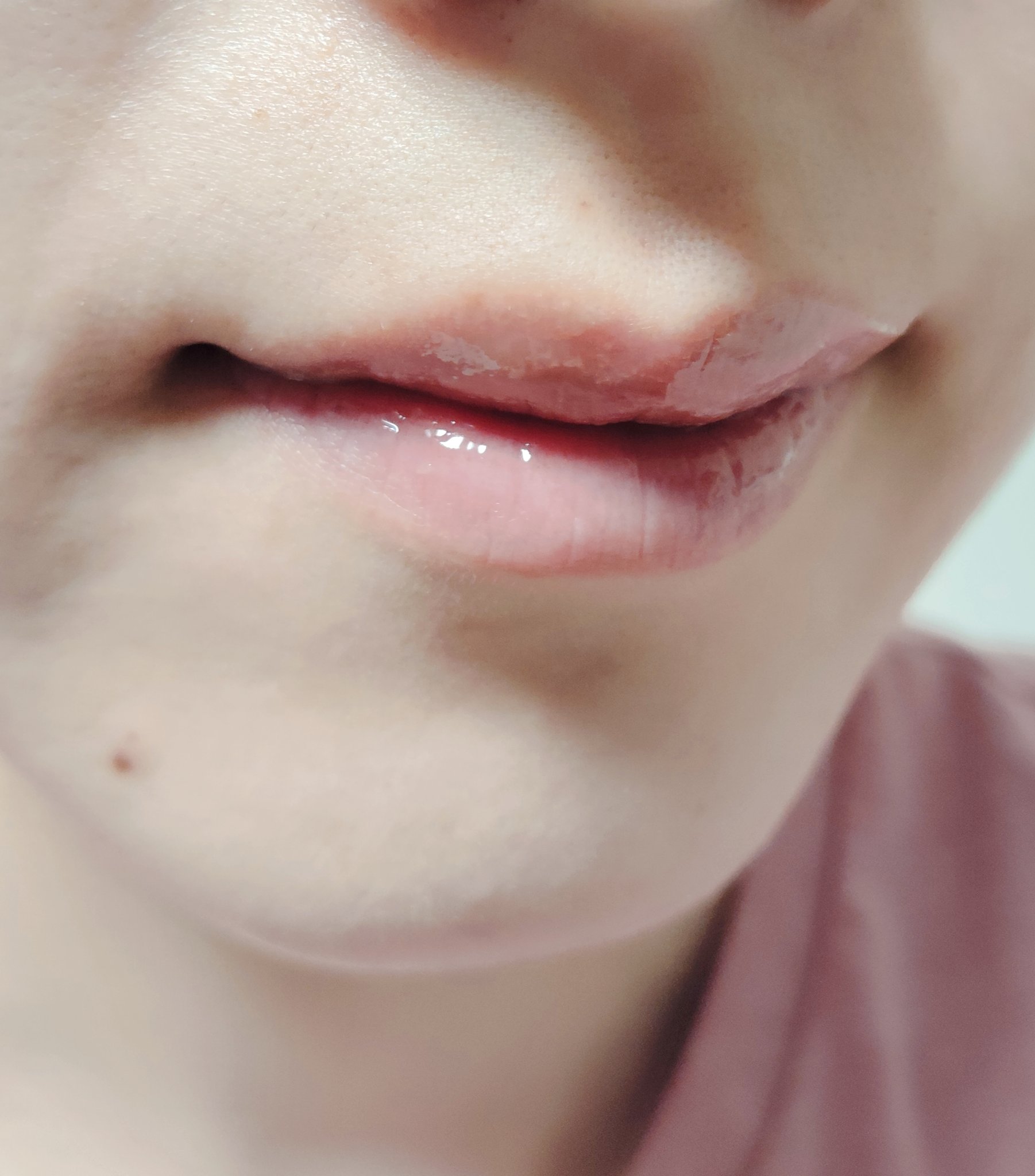 デイニードルリップ/CHOOSY/リップ美容液を使ったクチコミ（3枚目）