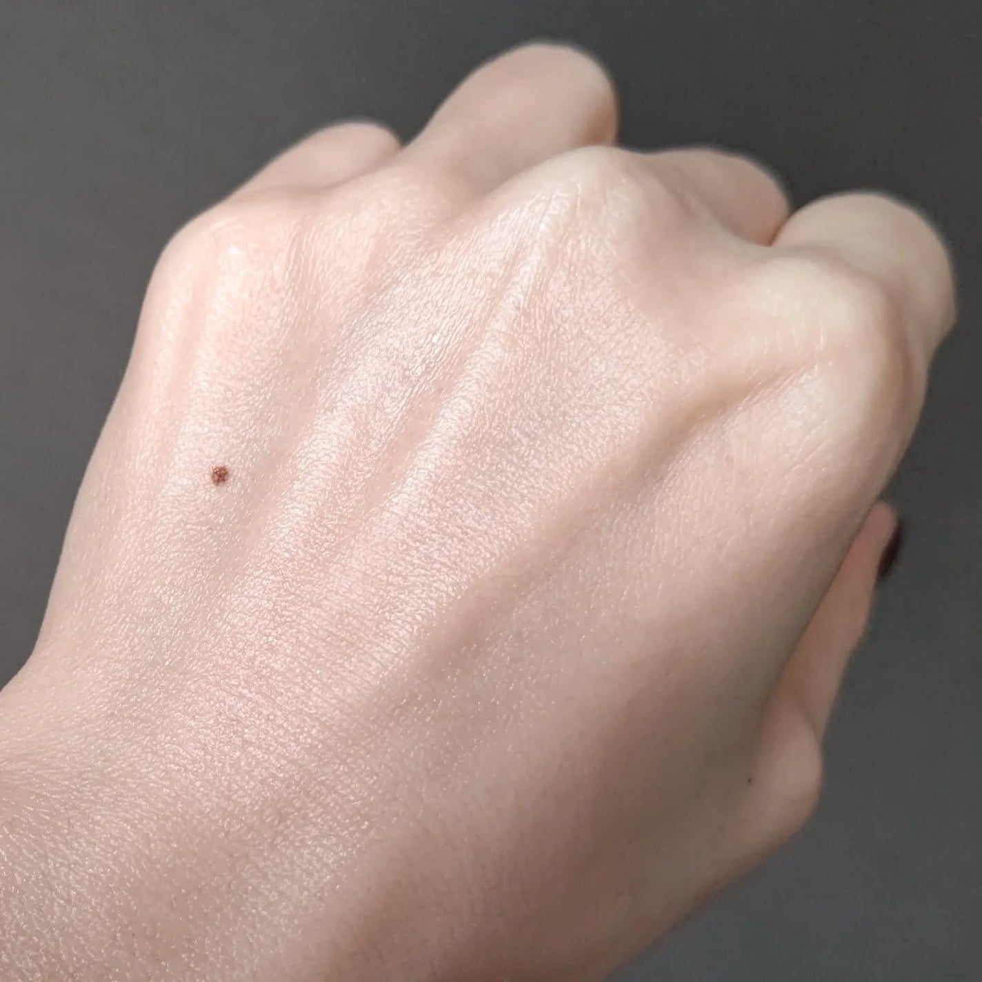 オードムーゲ 薬用ローション(ふきとり化粧水)/オードムーゲ/拭き取り化粧水を使ったクチコミ(2枚目)